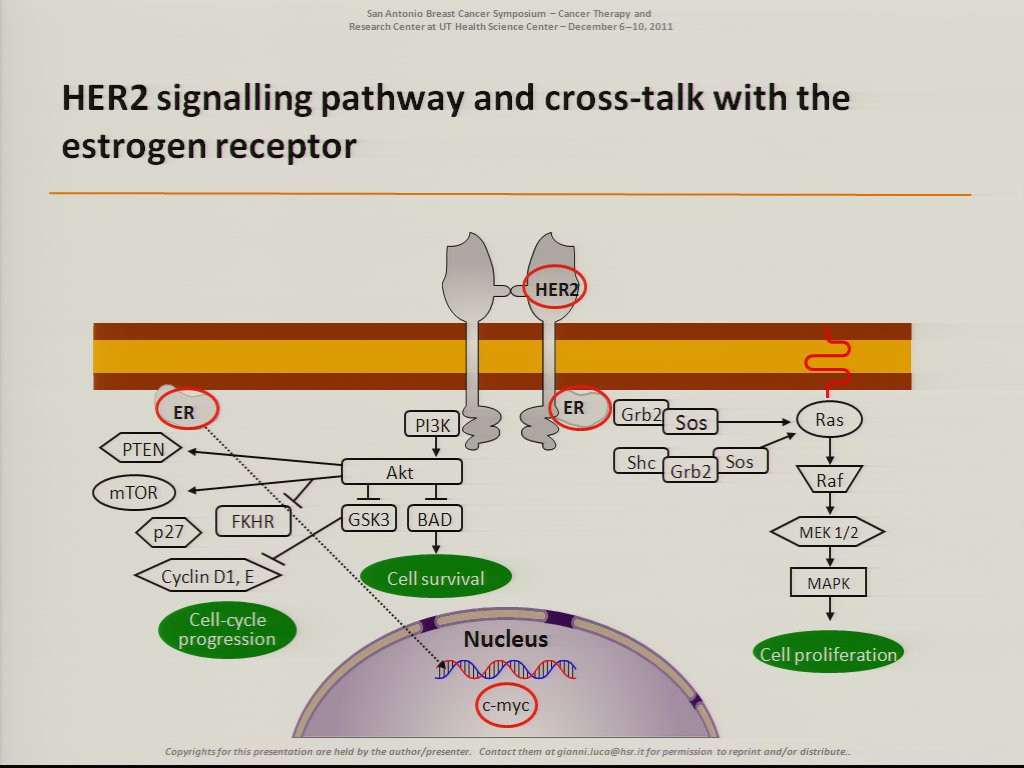 健康・医学 Preneoplasia of the Breast Peri-operative atezolizumab in early-stage triple-negative